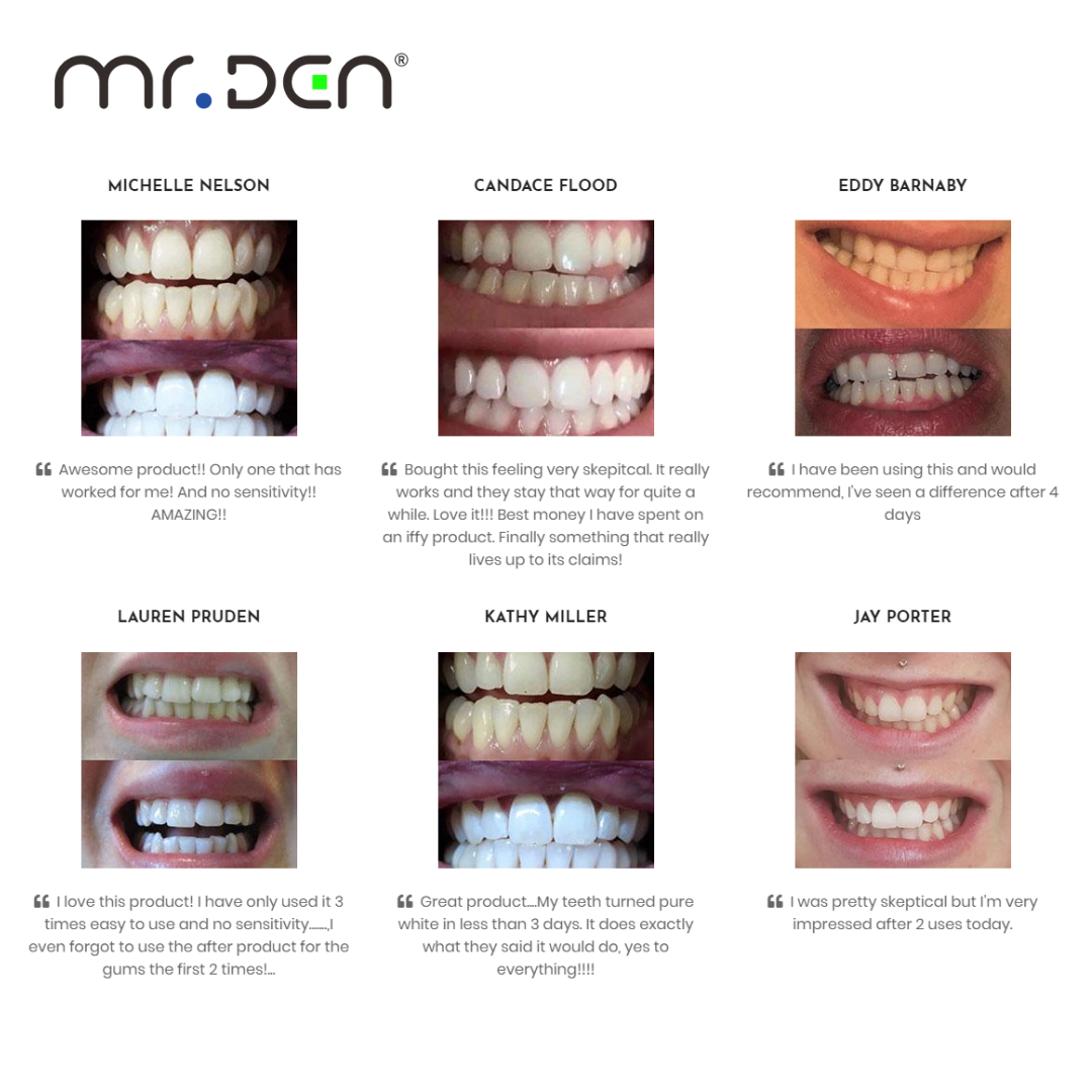 Dr. Whiten 3 Pack Teeth Whiten - огляд і ціна Teeth Whitening Kit Professional