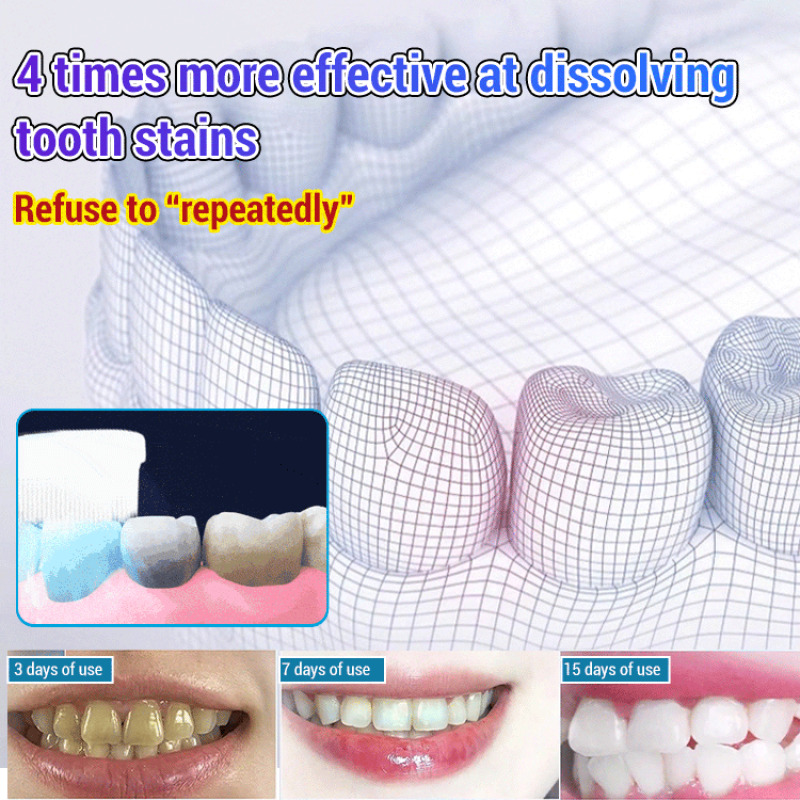 Baking Soda Whiten Teeth Fresh - огляд і ціна Teeth Whitening With Baking Soda