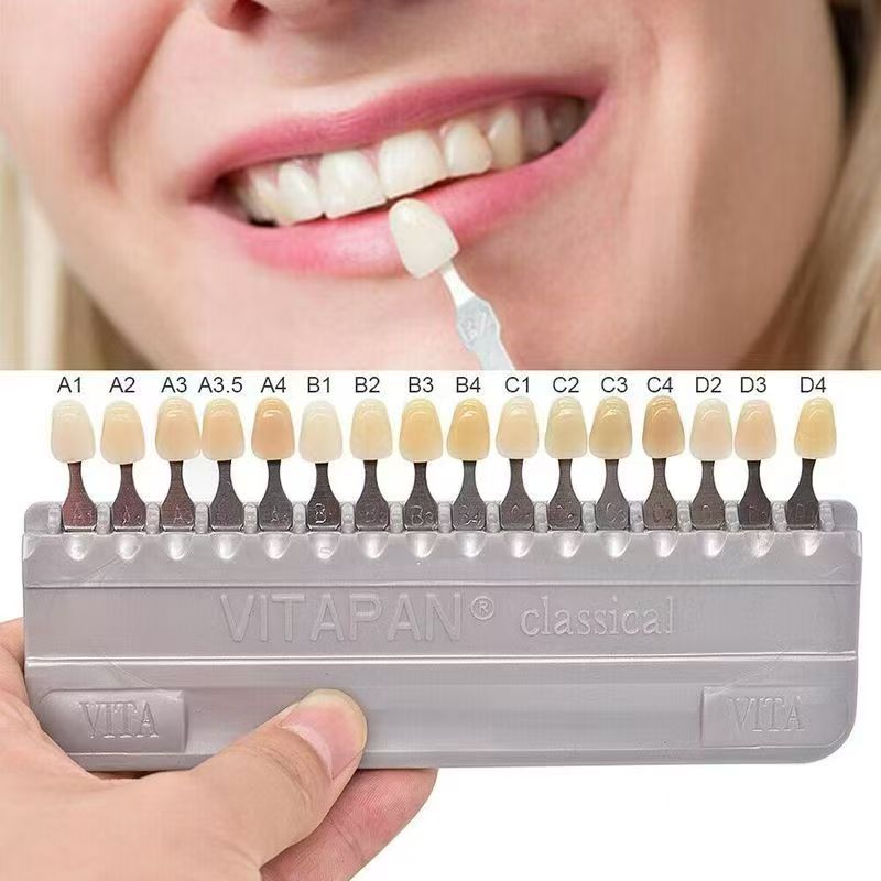 VITA 16 Colors Teeth Shade Gui - огляд і ціна Teeth Whitening Kit Professional