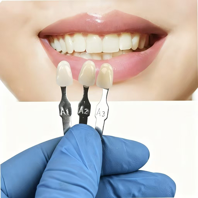 VITA 16 Colors Teeth Shade Gui - огляд і ціна Teeth Whitening Kit Professional