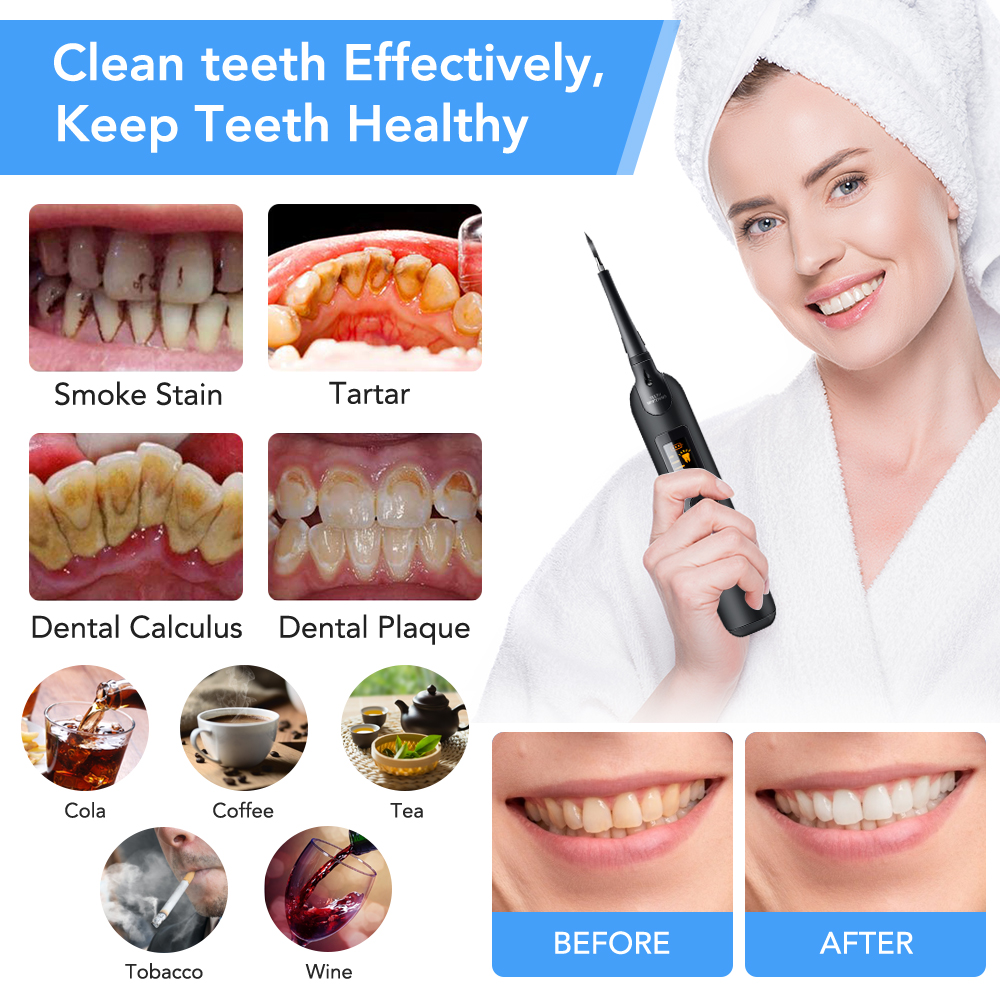 Teeth Tartar Remover Electric  - огляд і ціна Teeth Whitening Home Kit