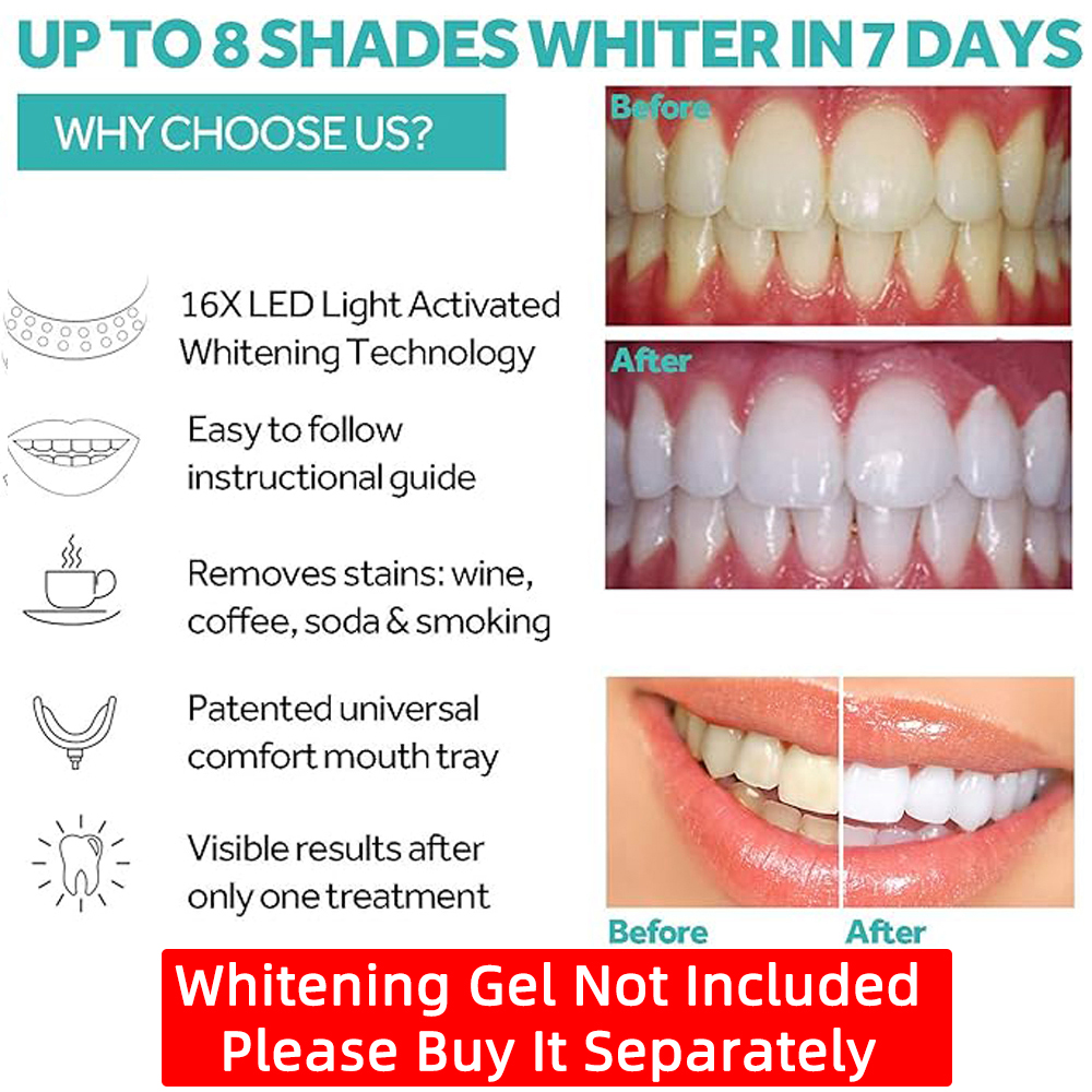 Vaclav Teeth Whitening Light K - огляд і ціна Led Mouth Tray