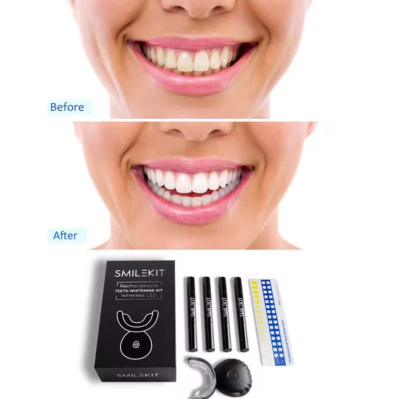 Wholesale Approved Private log - огляд і ціна Teeth Whitening Gel
