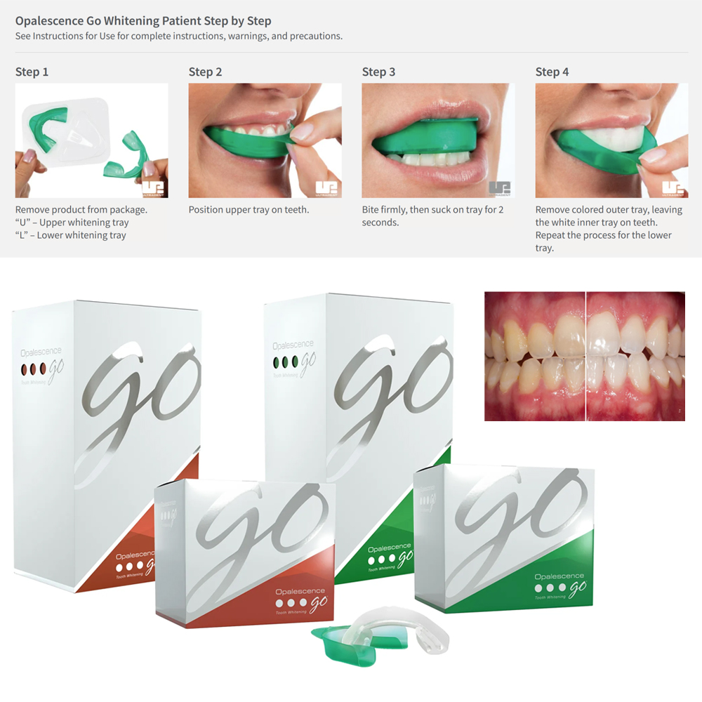 Opalescence Go Teeth Whitening - огляд і ціна Teeth Whitening Home Kit