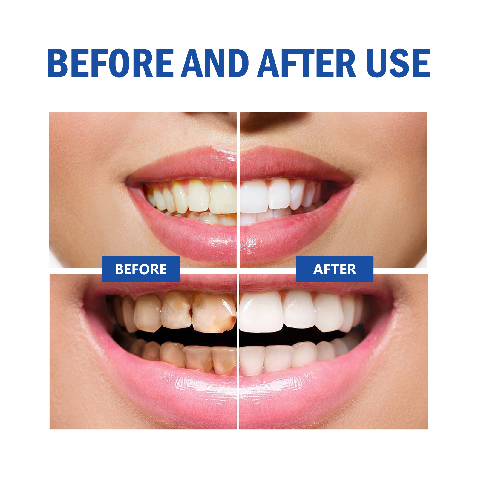 Teeth Whitening Powder Remove  - огляд і ціна Teeth Whitening Xylitol Gum