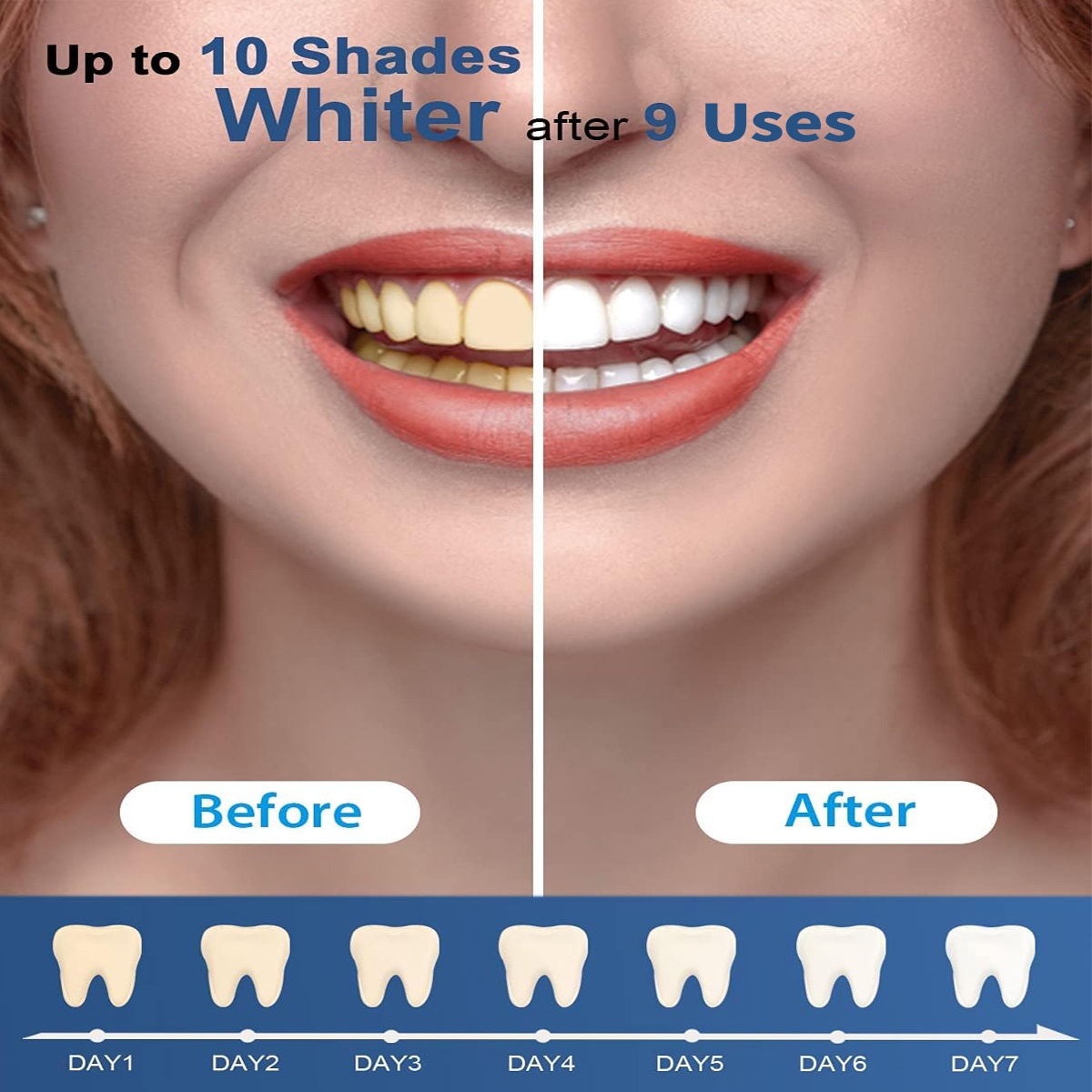 Teeth Whitening Kit - 5X LED L - огляд і ціна Teeth Whitening Home Kit